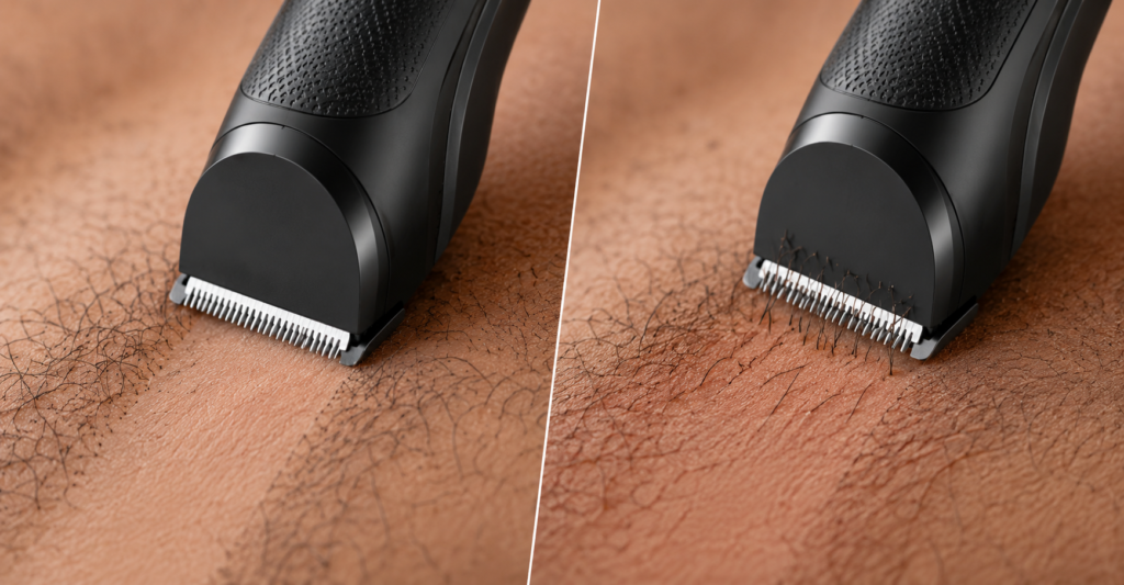 body trimmer pulling hair